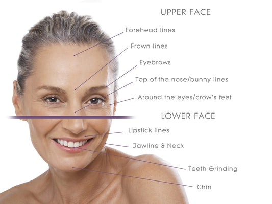 Is Botox the fix for all facial wrinkles?