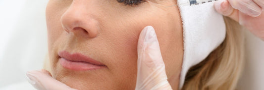 How long does Botox last?