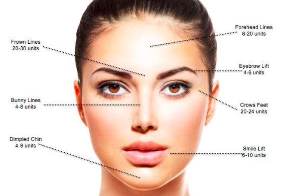 BOTOX Wrinkle Removal