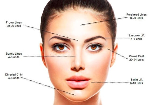 BOTOX Wrinkle Removal