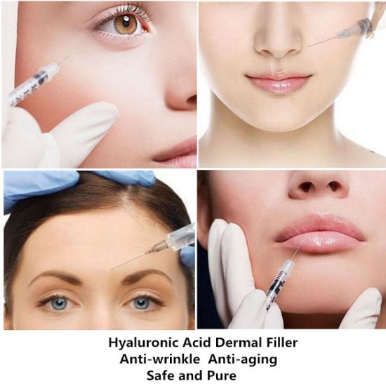 What are dermal fillers?