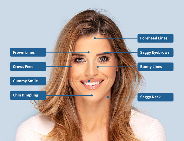Botox which reduces skin wrinkles