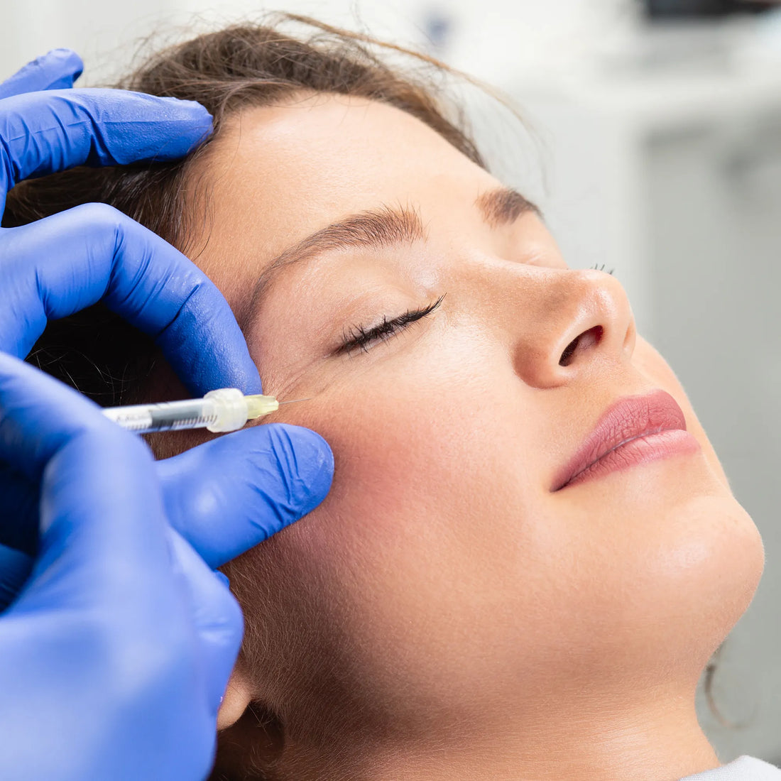 Botulinum toxin (Botox) A for reducing the appearance of facial wrinkles