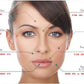 For Deep Wrinkles Lip Plumping Hyaluronic Acid Filler Lip Injection
